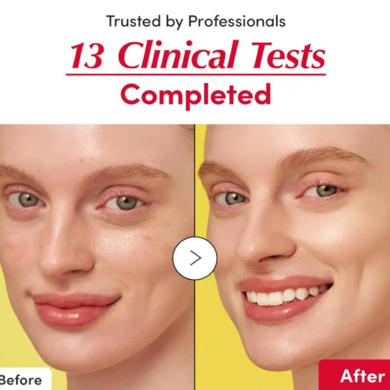 Vitamin C & Niacinamide Brightening Serum