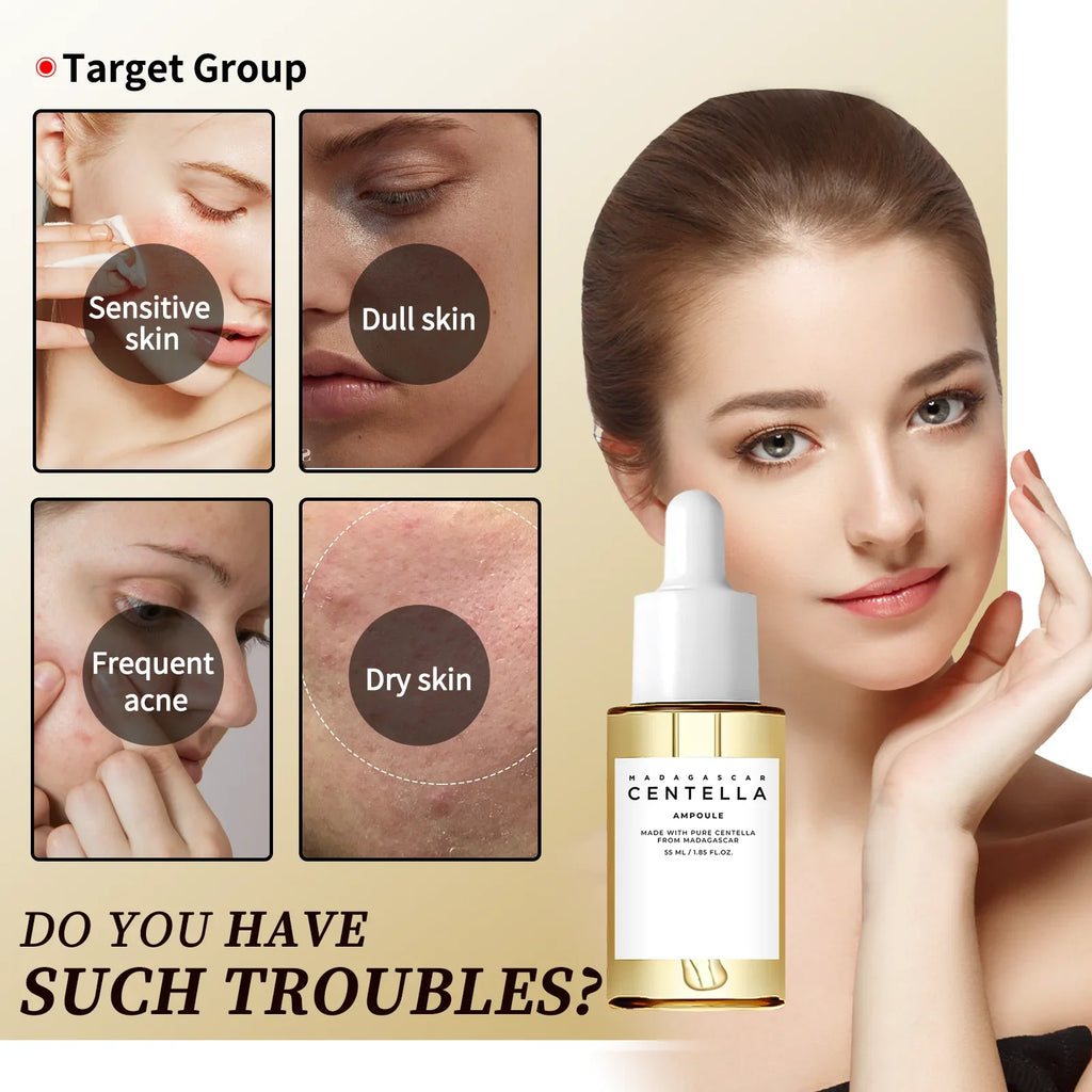 Sensitive Skin Comfort Serum 55ml