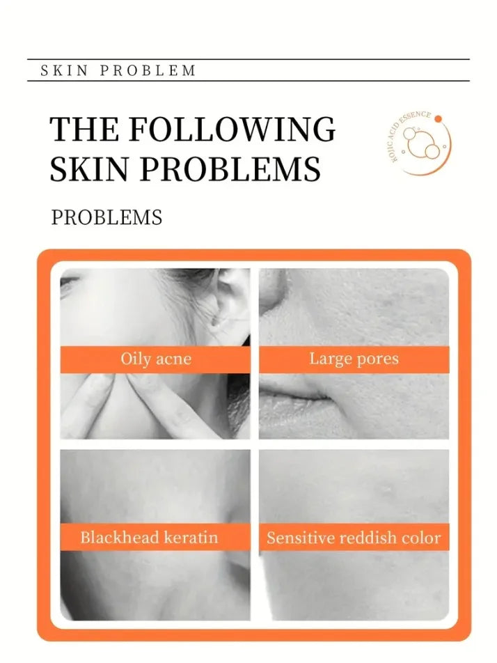 Kojic Acid Brightening Soap 100g